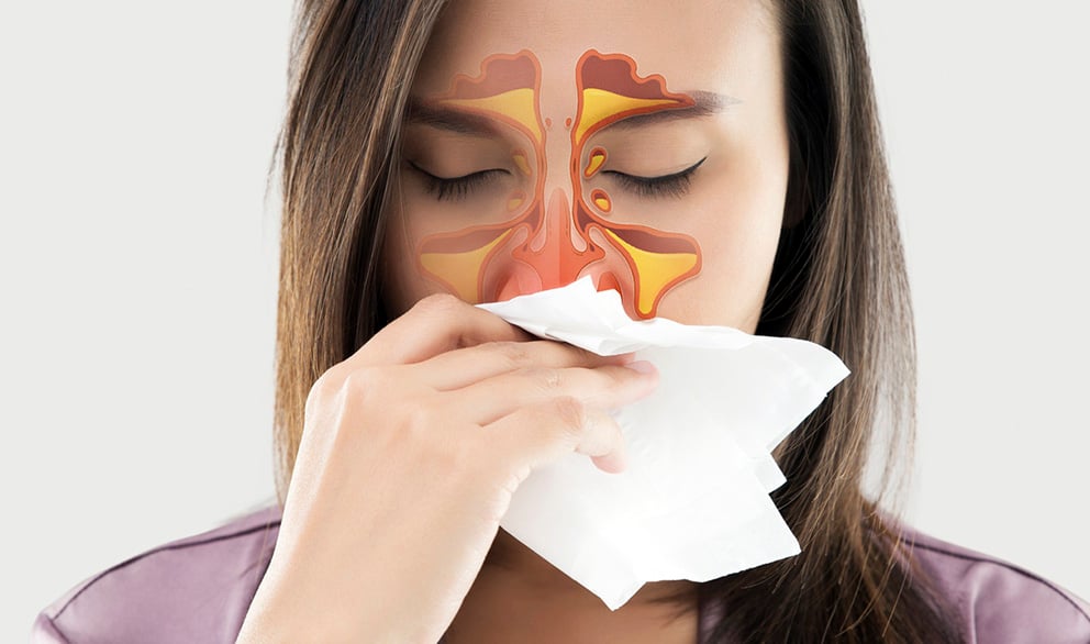 Sinus problems can lead to bad breath